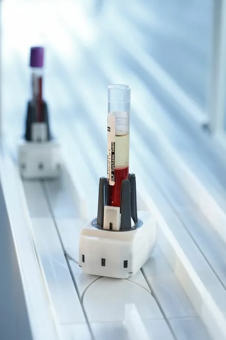 Bild 6:	Automatisches Probenverteilsystem mit hoher Flexibilität: Es befördert jede Probe einzeln, da so eine flexible, individuelle und optimierbare Organisation einzelner Proben möglich ist. (Urheber: GLP Systems)