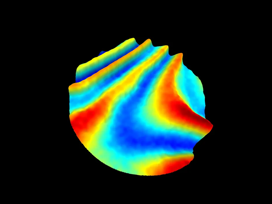 Bild 3:	Typische Anwendungsbeispiele für Scanning-Interferometer sind Ebenheitsmessungen an Wölbungen von Membranen. (Urheber: Polytec)