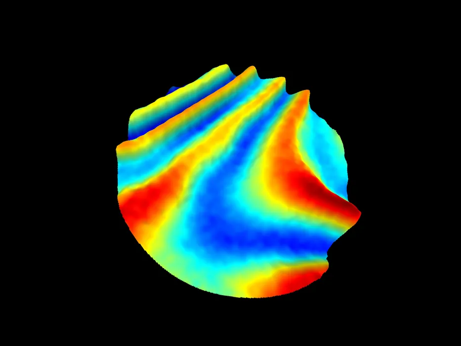 Bild 3: Typische Anwendungsbeispiele für Scanning-Interferometer sind Ebenheitsmessungen an Wölbungen von Membranen. (Urheber: Polytec)